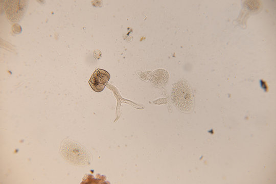 Study Movement and Specimens of Transversotrema patiallensis (parasite) under the microscopic in laboratory.