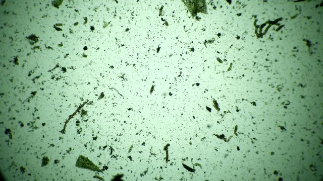 Moving a large number of infusoria and microorganisms. Microcosmic green background timelapse in a drop of water under a microscope. Theme of laboratory microscopic protozoa in a drop magnification.