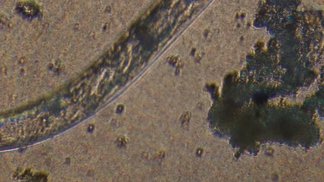 Microscopy of parasite worm nematode (Strongyloides stercoralis). Closeup movement of active parasite form in magnification 300x.