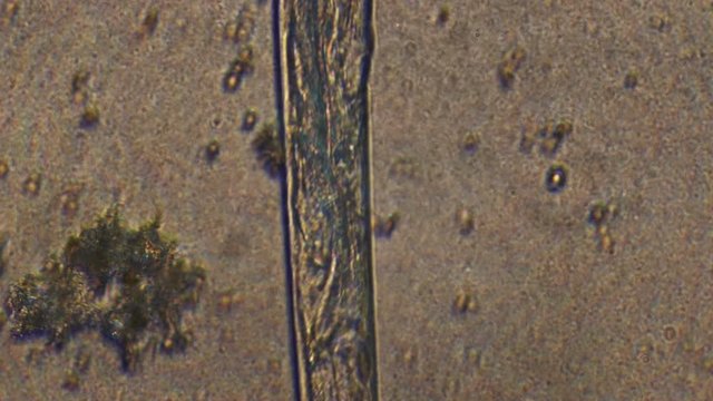 Microscopy of parasite worm nematode (Strongyloides stercoralis). Closeup movement of active parasite form in magnification 300x.