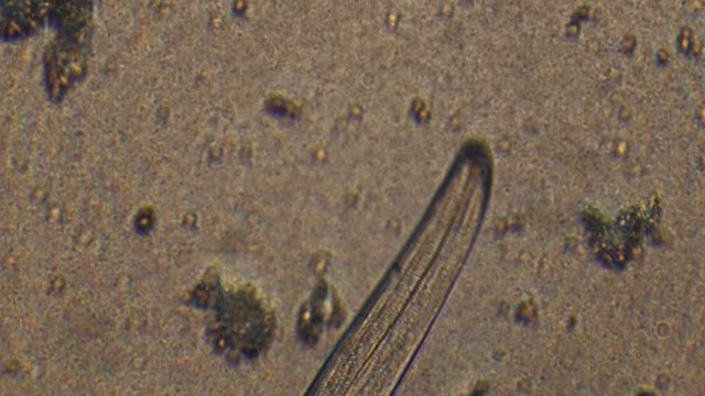 Microscopy of parasite worm nematode (Strongyloides stercoralis). Closeup movement of active parasite form in magnification 300x.