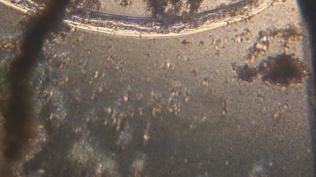 Microscopy of parasite worm nematode (Strongyloides stercoralis). Movement of active parasite infection form in magnification 150x.