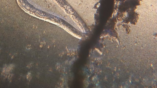Microscopy of parasite worm nematode (Strongyloides stercoralis). Movement of active parasite infection form in magnification 150x.