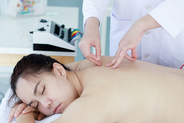 Obraz na płótnie Canvas hand of doctor performing acupuncture therapy . Asian female undergoing acupuncture treatment with a line of fine needles inserted into the her body skin in clinic hospital
