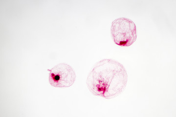 Noctiluca scintillans