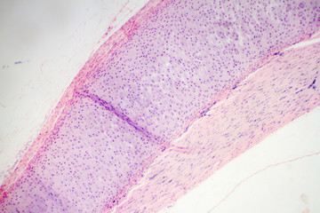 Hyaline cartilage