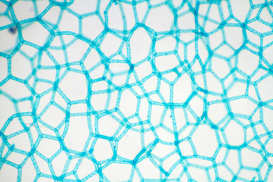 Hydrodictyon showing its net like mesh of cells. Microscope view at 40x.