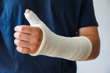 Man with plaster cast on broken hand, broken thumb,broken wrist