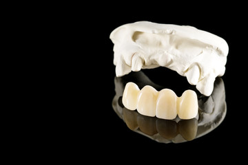 Closeup / Prosthodontics or Prosthetic / Tooth crown and bridge implant dentistry equipment and...