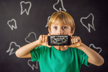 The boy shows his X-ray image of his teeth with an abnormally strange extra tooth. Children's dentistry. Patient Orthodontist