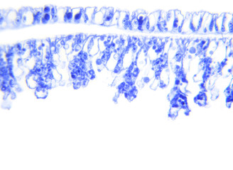 Longitudinal section of the Hydra under the microscope (Hydra L.S.)