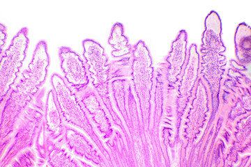 Сross-section of the small intestine under the microscope (Small Intestine Sec.)