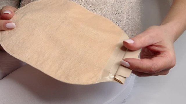 Colostomy bag, supply needed after colostomy surgery - colon cancer treatment. 2 piece ostomy bag in skin color. Medical theme. Stoma bag ready to use