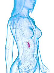 3d rendered medically accurate illustration of a diseased gallbladder