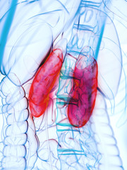 3d rendered medically accurate illustration of diseased kidneys