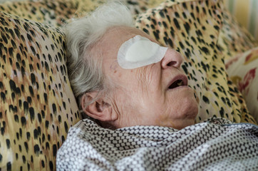 an old person with eye bandage after cataract operation