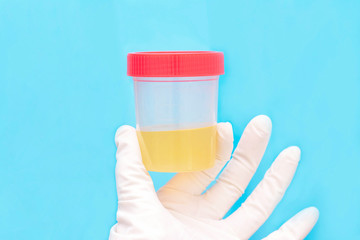 medical analysis of urine. The doctor holds in his hand a urine test in a jar with a red lid. healthcare and medicine.