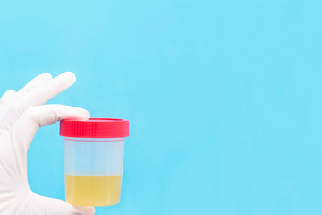 medical analysis of urine. The doctor holds in his hand a urine test in a jar with a red lid. healthcare and medicine. place for your text. mockup