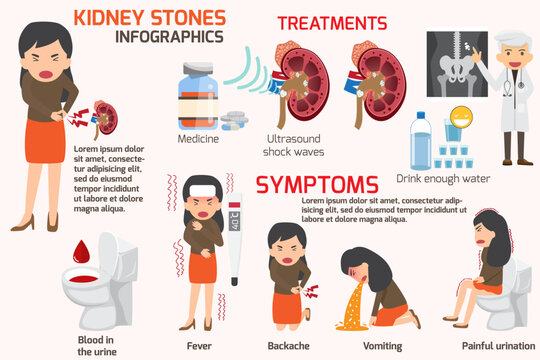 Image result for Winning Over Kidney Stones infographics