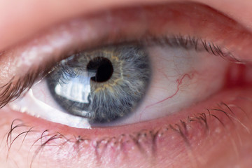 Blue eye