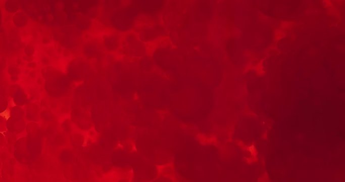 Small red blood cells in fluid