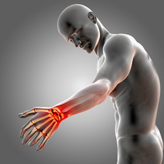 3D render of a medical male figure showing his painful wrist with joints highlighted