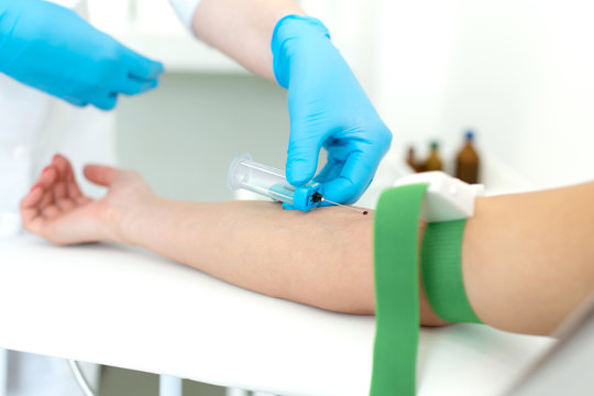 a gloved nurse inserts a needle into a vein on the patient arm and draws blood into a vacuum container. Blood sampling procedure