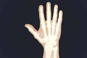 X-rayed human hand. X-ray of hand bones.