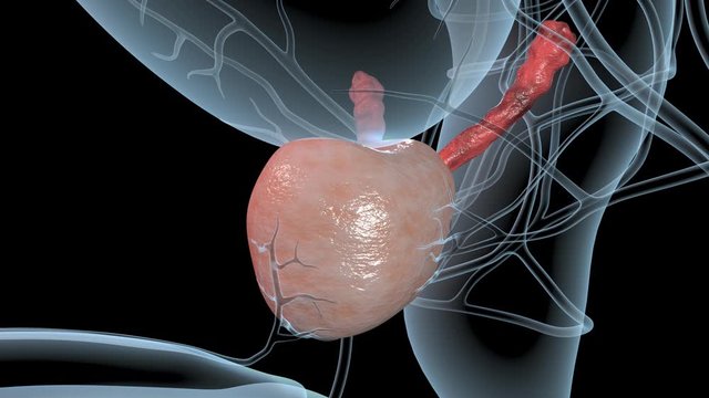 Prostate Cancer