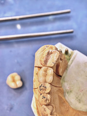 Plaster cast of human jaws. Dental casting gypsum model jaws