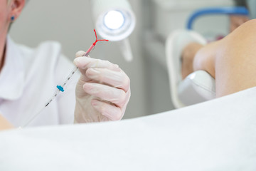 Gynecologist holding an IUD birth control device before using it for patient