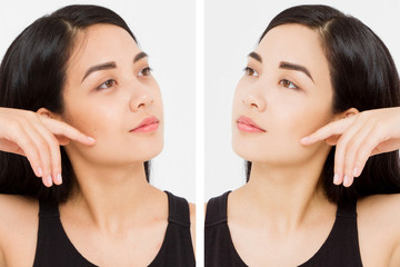 Asian close up woman happy face before after cosmetic procedures. Skin care wrinkled face, dark circles under eyes. Before-after anti-aging facelift treatment. Facial skincare, beauty contouring