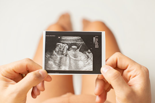 Top view of a woman holding photo of an ultrasound machine of her unborn child
