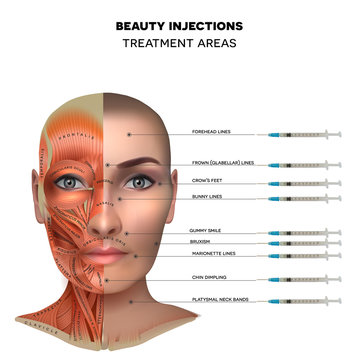 Beauty aesthetic injections treatment area