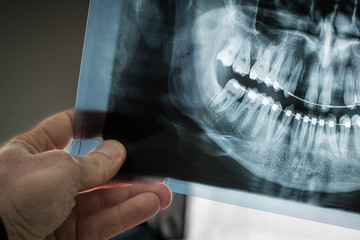 Hand is visible holding an x-ray dental scan of a person with braces on teeth, with visible traces...