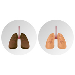 Comparison between healthy lung and cancer lung isolated on white background. Icon illustration