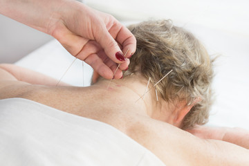 Elderly woman undergoing acupuncture procedure in a spa.