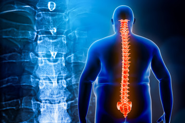 Back view of an obese man with its spine or backbone and vertebrae x-ray in the background. Overweight and back injury 3d rendering illustration. Backache, pain, healhcare and medical concepts.