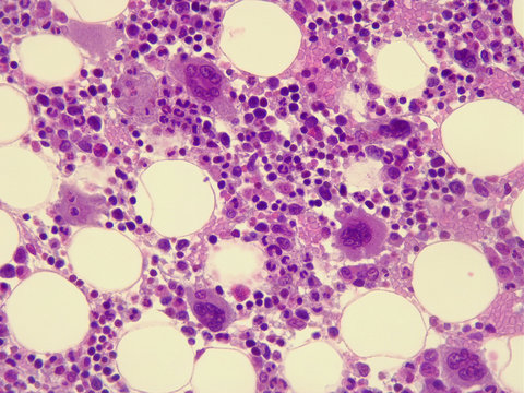 Human bone marrow under the microscope. (400x magnification)