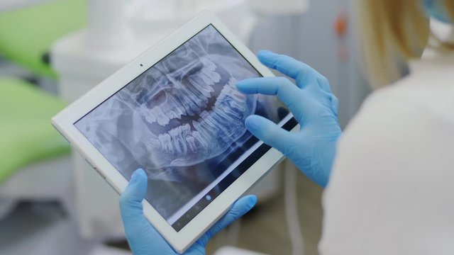 Dentist shows on the tablet x-ray teeth, close-up. Modern dentistry. X-ray of the teeth on a portable device