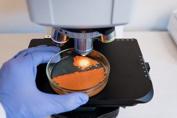 Examine bacteria on a petri dish under the microscope. Close-up doctor puts a petri dish with...