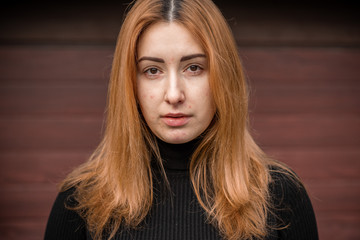 Acne and scars, simple woman close up natural portrait, No makeup and retouch. Problem skin