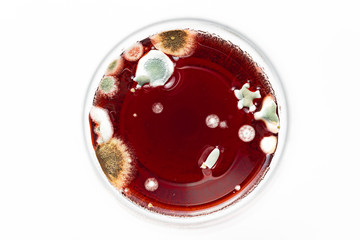 image of bacteria in a petri dish
