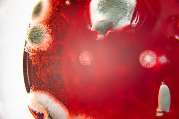 image of bacteria in a petri dish