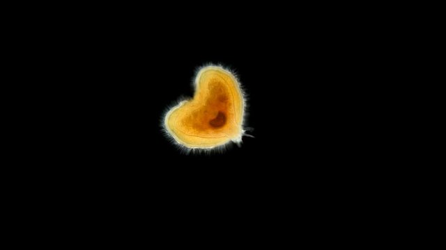 Entoprocta larva under a microscope, a type of Protostomia animals, used to be considered as members of Trochozoa, are actually closely related to bryozoans, perhaps this is a new species, there is ve