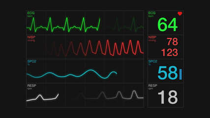 closeup view of an ecg ekg display