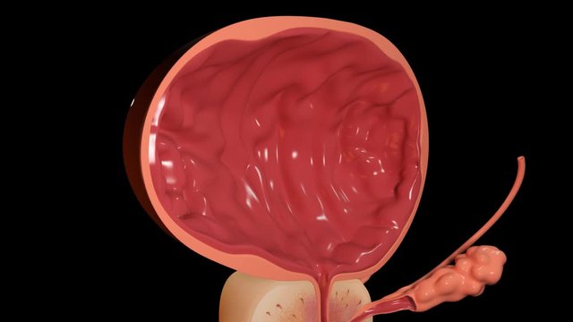 Prostate and Bladder Section