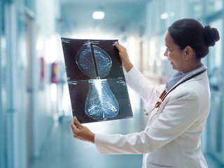 Female doctor looking at the Mammogram film image  in hospital for health care checking and breast cancer prevention. Medical and health care concept.