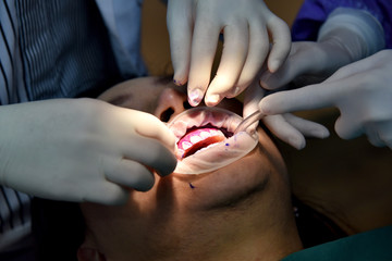 Dental care check up, Dentist examining and doing teeth treatment in dental clinic, Yearly visit for teeth cleaning and scaling to prevent gum disease problems, Healthy oral hygienic.