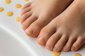 Feet with fungal toe nail infection. Colse-up